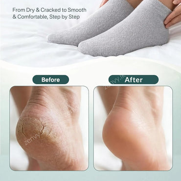 Buy Original Moisturizing Gel Socks Online in Sri Lanka | Zenvy.lk 