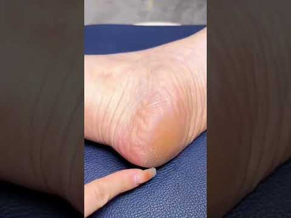 Buy Electric Callus Remover for Feet Online in Sri Lanka